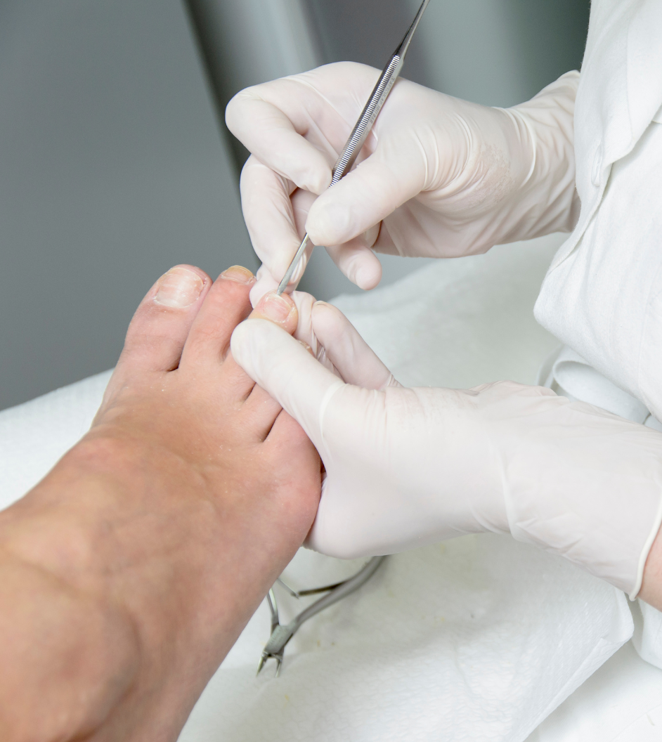 Medisch pedicure Hoenderloo