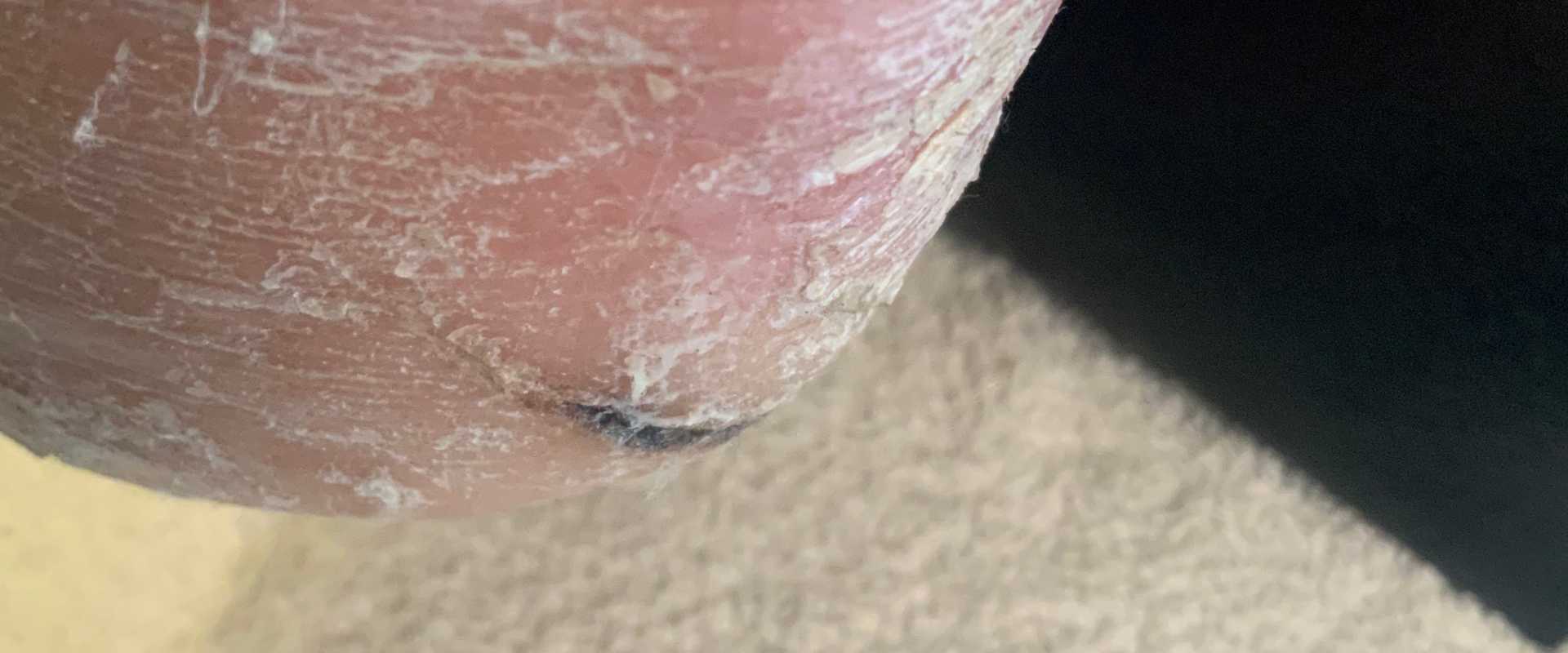 Medisch pedicure Hoenderloo