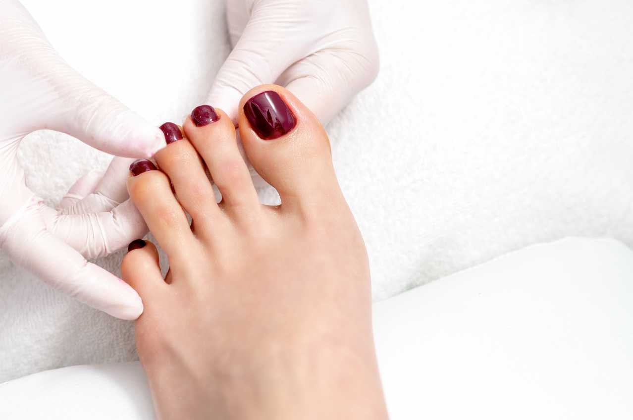 Medisch pedicure Hoenderloo
