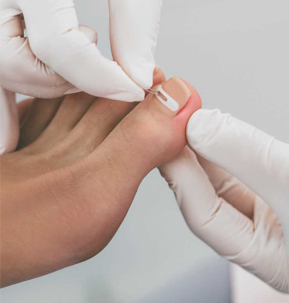 Medisch pedicure Hoenderloo Medisch pedicure Hoenderloo