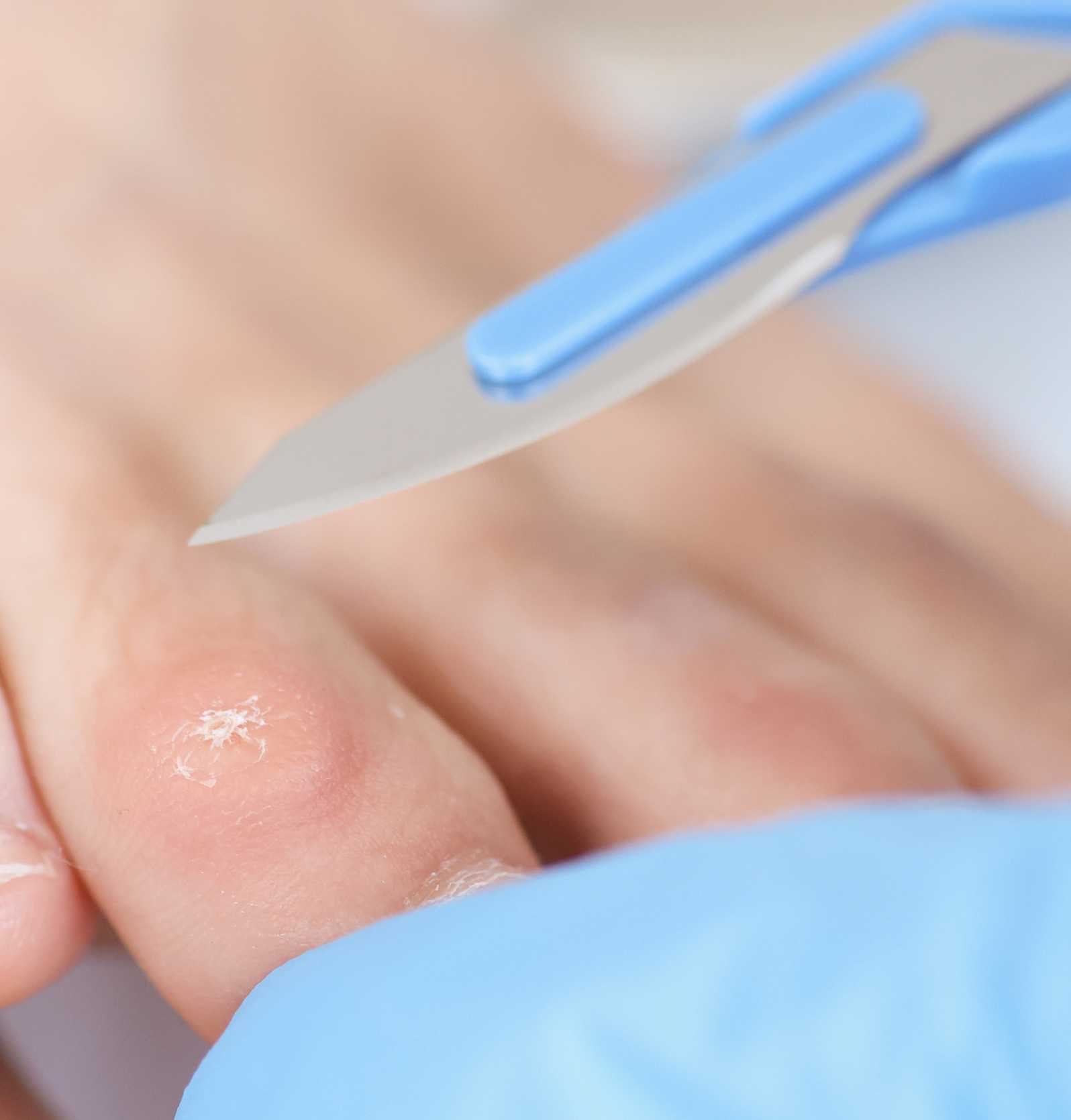 Medisch pedicure Hoenderloo