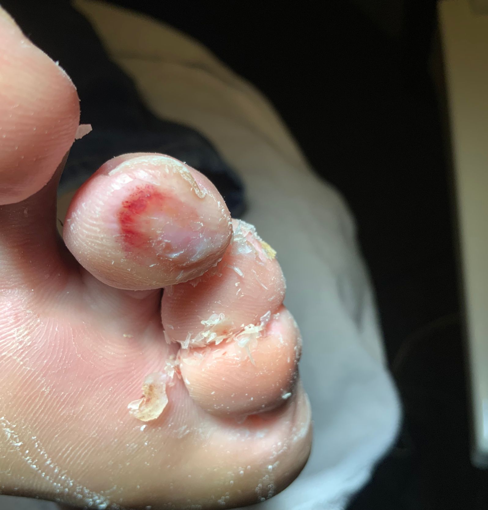 Medisch pedicure Hoenderloo Medisch pedicure Hoenderloo