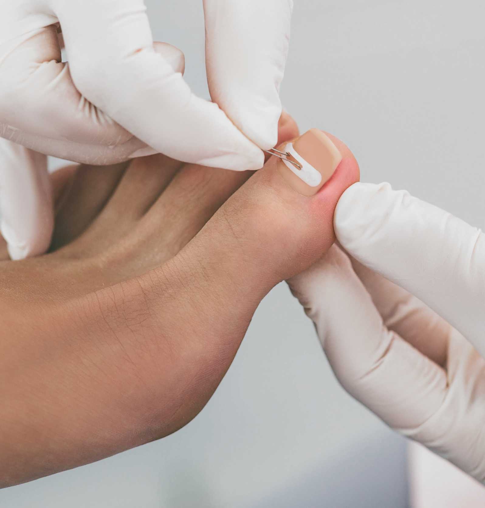 Medisch pedicure Hoenderloo