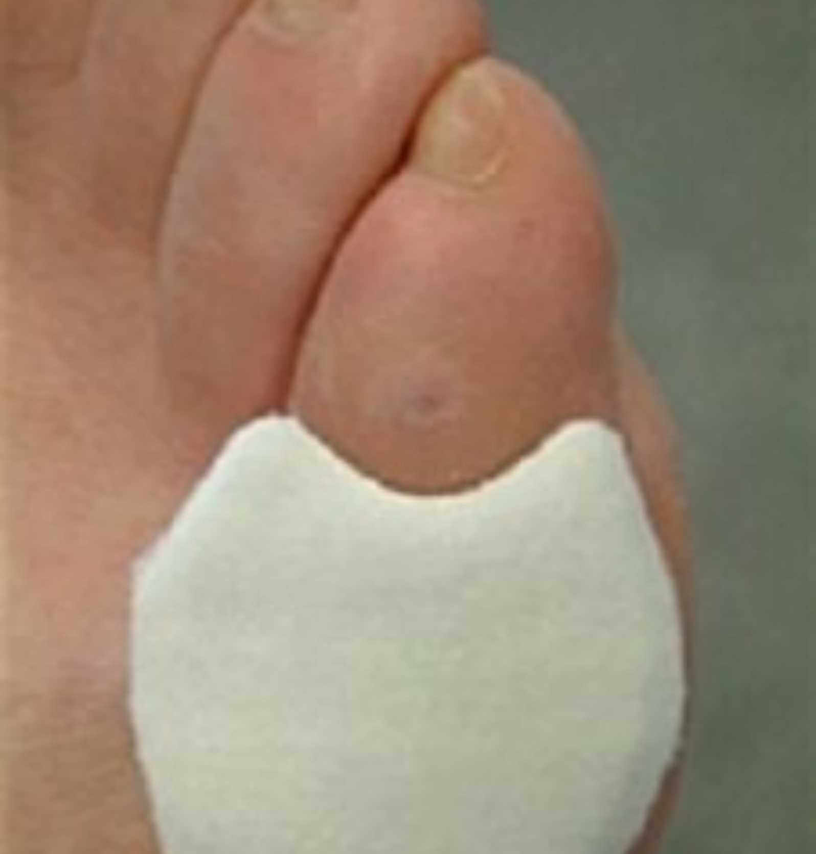 Medisch pedicure Hoenderloo